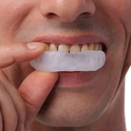 Man inserting a custom mouth guard, illustrating preventative dental care for bite issues and teeth alignment at Dental Group of Westchester.
