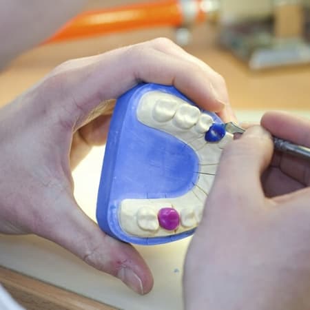 One of our expert dentists holding a mold of teeth with different colors on some of the teeth