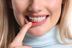 gum disease treatment at Dental Group of Westchester